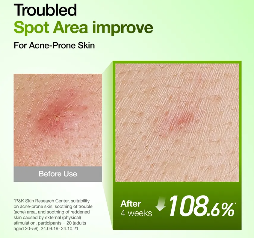 Anua x KDH Acid 10 Hyaluron Redness Soothing Serum (50ml)