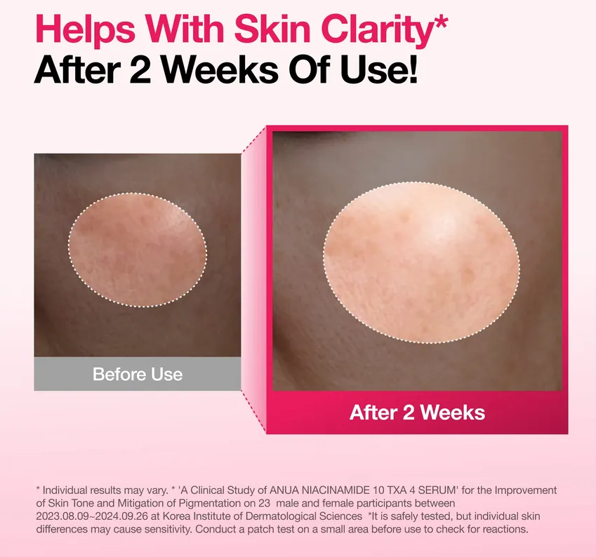 Anua x KDH niacinamide 10 TXA 4 serum (50ml)